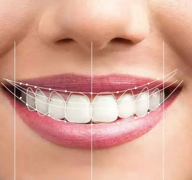 estetik-dis-hekimligi-1111